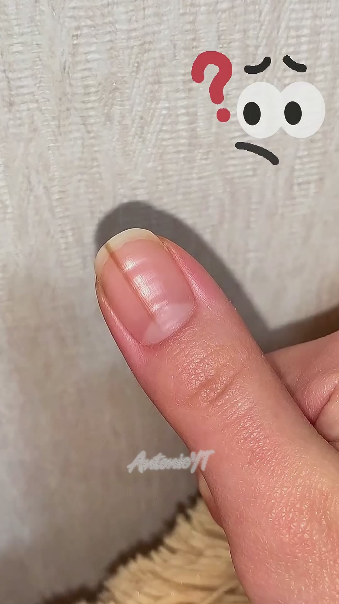 ¡El PELIGRO OCULTO de las líneas en las uñas! ⚠️💅😱